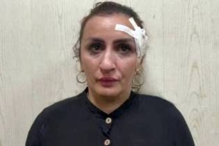 Mulher vende filho recém-nascido por R$ 28 mil para pagar plástica no nariz