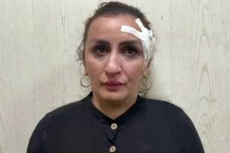 Mulher vende filho recém-nascido por R$ 28 mil para pagar plástica no nariz