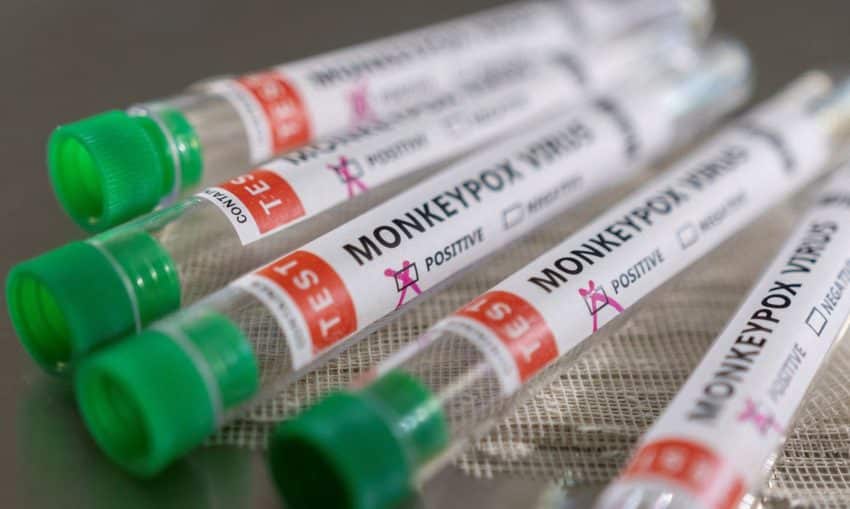 Monkeypox: Amazonas confirma 4 novos casos