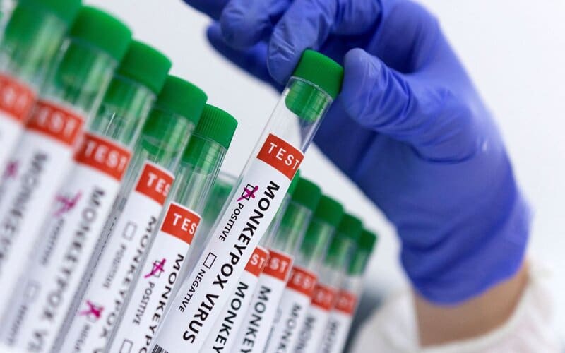 Brasil negocia compra de vacina contra varíola dos macacos 
