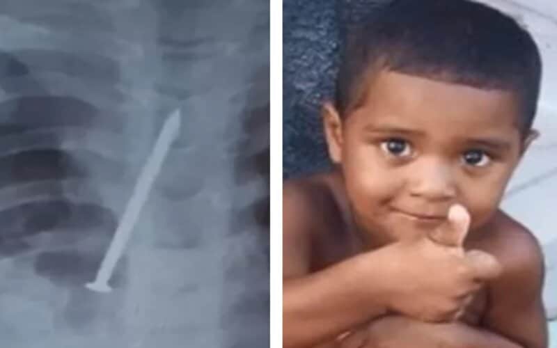 Família acusa hospital de negligência após deixar menino morrer com prego no pulmão