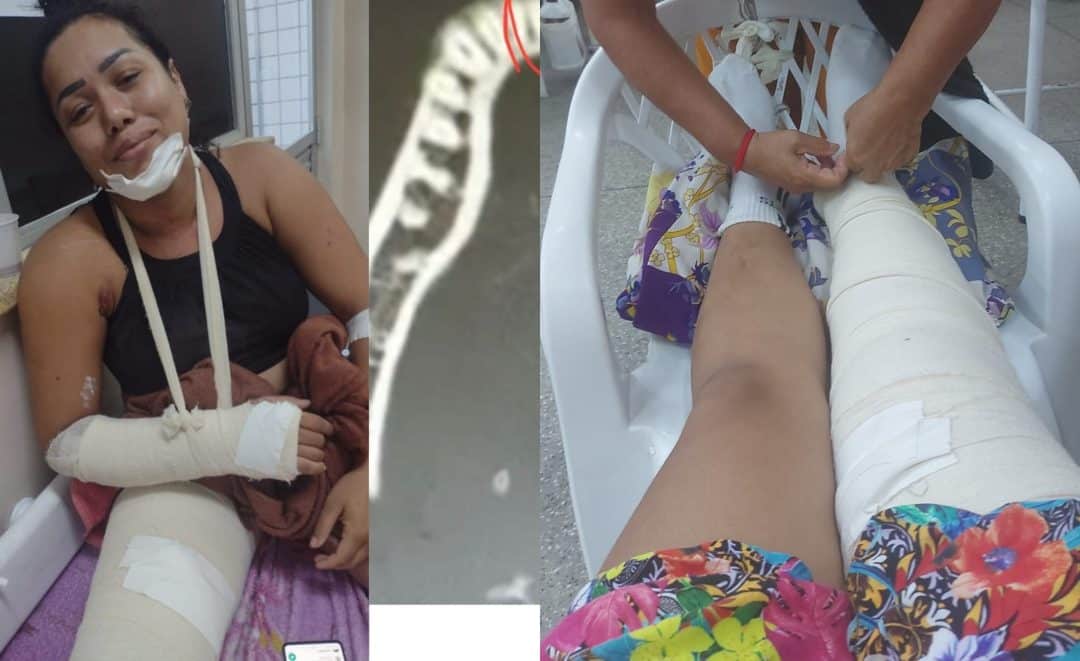 Família pede ajuda para cirurgia de jovem que sofreu acidente de moto, em Manaus
