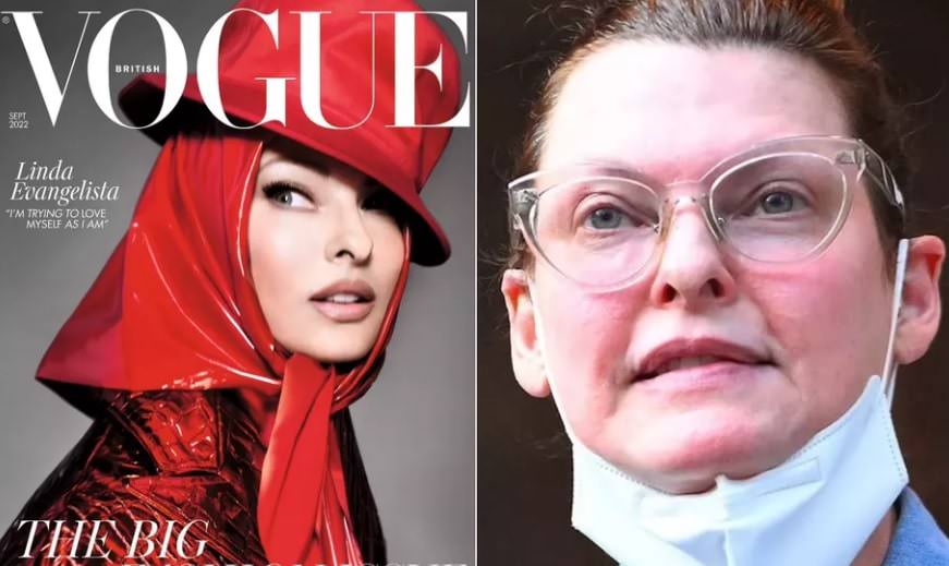 Linda Evangelista esconde cirurgia estética fracassada com fitas para capa da Vogue