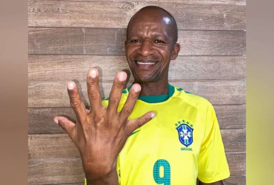 Ansioso para comemorar o hexa, brasileiro de seis dedos viraliza na internet