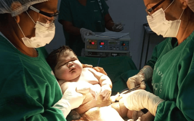 Em Parintins, bebê nasce com mais de 7kg e precisa de doações