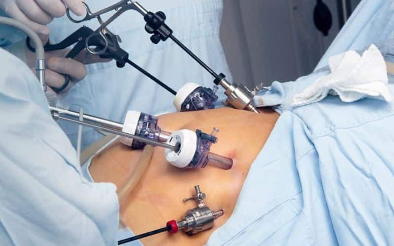 cirurgia bariátrica