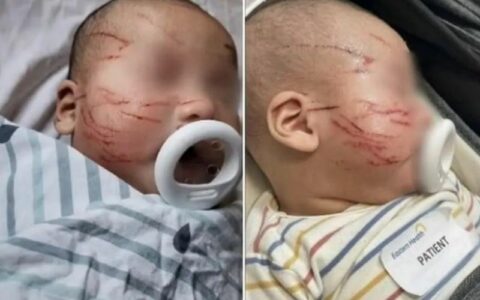 Mãe se desespera ao encontrar seu bebê com rosto arranhado mais de 20 vezes