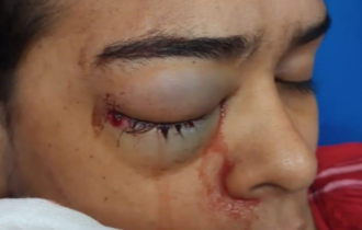 Mulher é atingida no olho por bala de ar comprimido durante arraial em shopping de Manaus