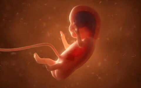 Aborto