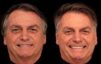 Bolsonaro faz harmonização facial e web reage: 'com o dinheiro das joias'