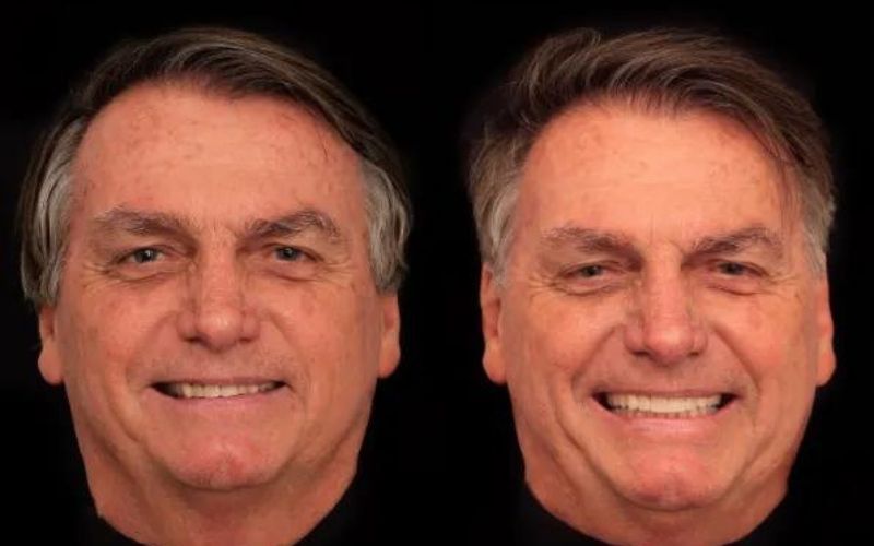 Bolsonaro faz harmonização facial e web reage: ‘com o dinheiro das joias’