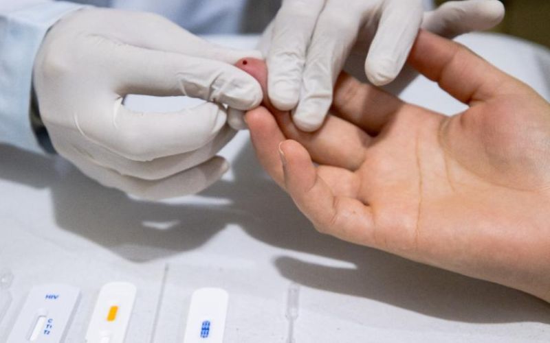 Com tratamento, pessoa com HIV pode ter carga viral ‘indetectável’