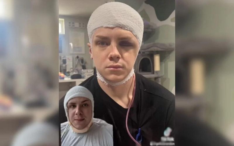 cirurgia-retira-parte-do-cerebro-foto-reproducao-redes-sociais