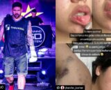Justiça decreta prisão de lutador de MMA por agredir namorada em Manaus