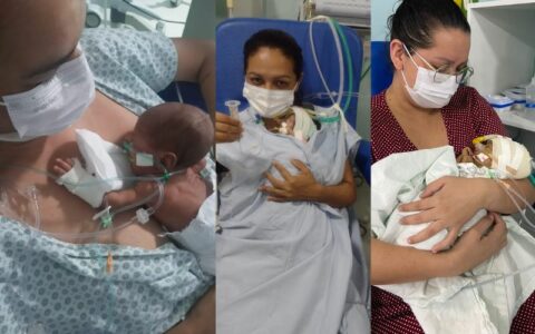 ‘Mães de UTI’ contam os momentos de dor e superação ao lado dos filhos prematuros
