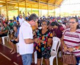 Governo do Amazonas inicia jornada para zerar filas de cirurgias oftalmológicas em Nhamundá