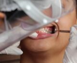 Brasil tem 45% de cobertura em saúde bucal