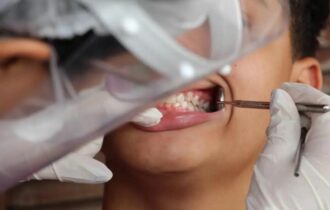 Brasil tem 45% de cobertura em saúde bucal