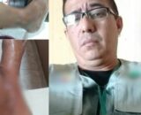 Cinegrafista quase perde a perna durante assalto em Manaus; ele pede ajuda para custear pós-operatório