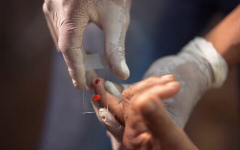 Garimpo ilegal impulsiona aumento de casos de malária na Amazônia