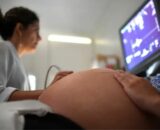 TJ-SP autoriza redução embrionária em gravidez de quíntuplos com risco de vida à mãe