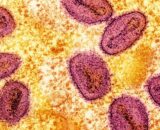 OMS alerta para variante mais perigosa de mpox