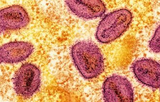 OMS alerta para variante mais perigosa de mpox