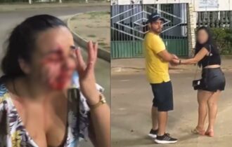 Em Pauini, investigador é afastado do cargo por suspeita de agredir mulher com soco no rosto