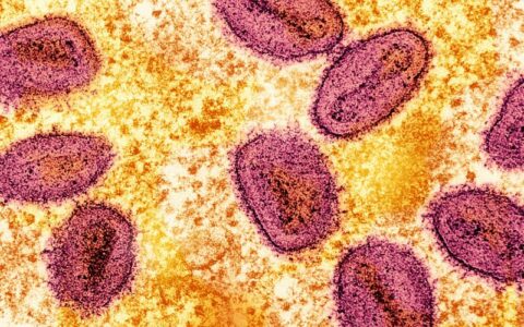 OMS alerta para variante mais perigosa de mpox