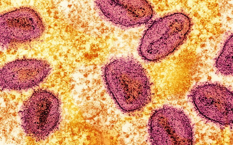 OMS alerta para variante mais perigosa de mpox