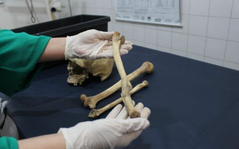 Peritos do Amazonas usam antropologia forense para identificar ossadas humanas