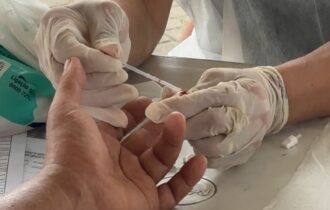 Brasil reduz mortalidade por hepatites, mostra boletim