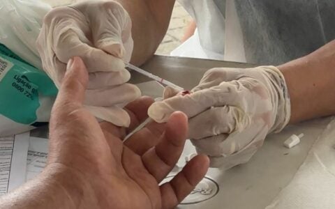 Brasil reduz mortalidade por hepatites, mostra boletim