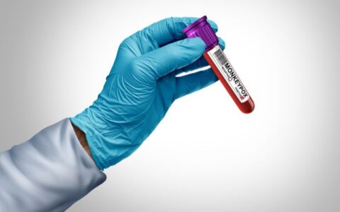 OMS avalia se mpox deve voltar a ser declarada emergência global