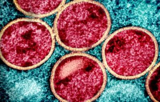 Casos de mpox no Brasil este ano já superam o total de 2023