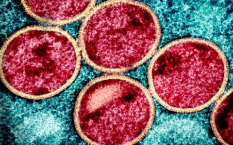 Casos de mpox no Brasil este ano já superam o total de 2023