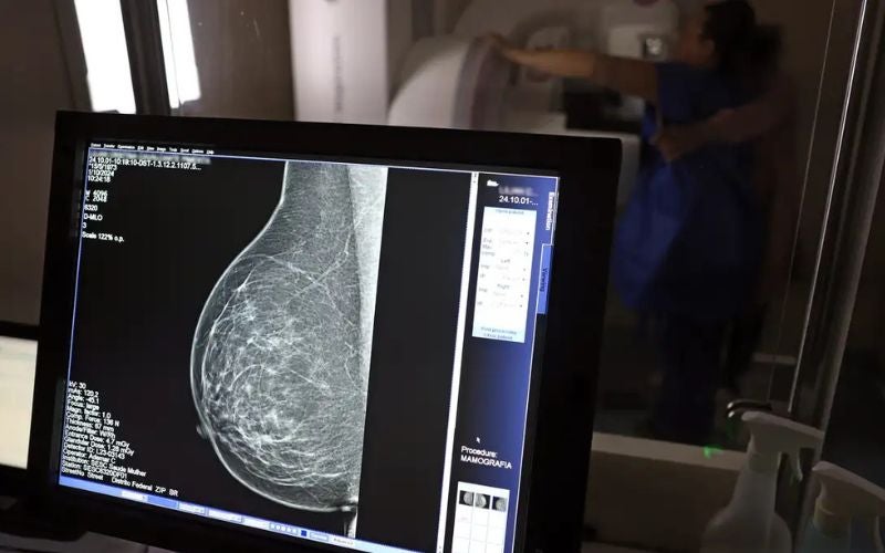 Mais de 77 mil mulheres aguardam para fazer exame de mamografia pelo SUS
