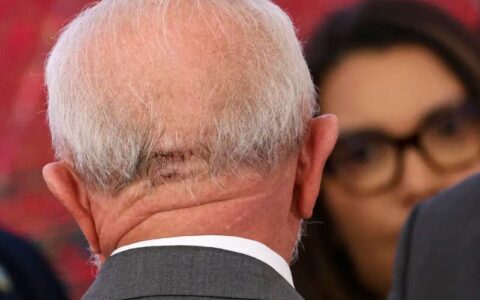 lula-faz-exames-em-brasilia-e-