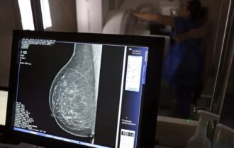 Mais de 77 mil mulheres aguardam para fazer exame de mamografia pelo SUS
