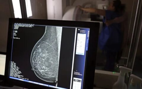 Mais de 77 mil mulheres aguardam para fazer exame de mamografia pelo SUS