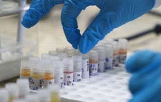 fvs-confirma-44-casos-de-mpox-