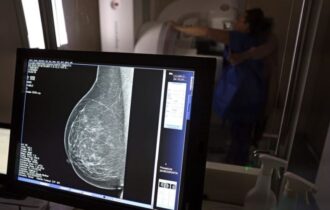 entidades-defendem-mamografia-