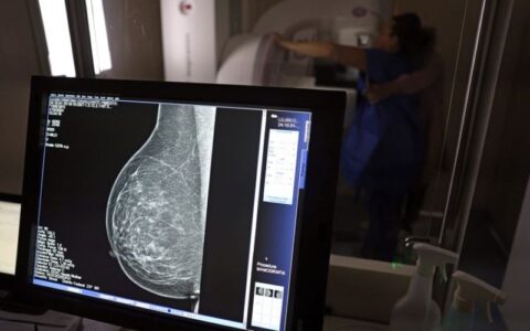entidades-defendem-mamografia-