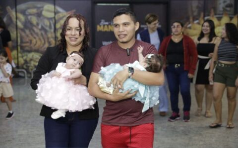 gemeas-siamesas-separadas-em-g