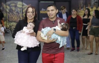 gemeas-siamesas-separadas-em-g