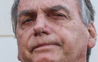 bolsonaro-passa-por-procedimen