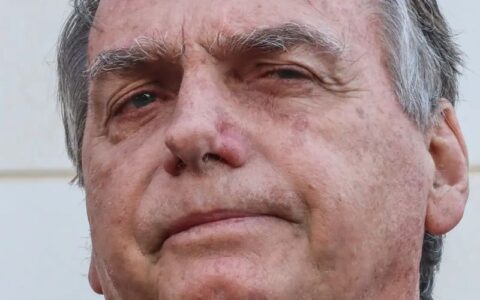 bolsonaro-passa-por-procedimen