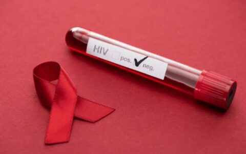 unaids-diz-que-combate-a-desig