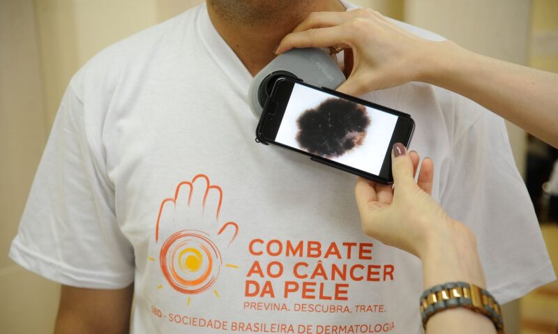 ate-2028-brasil-aponta-781-mil