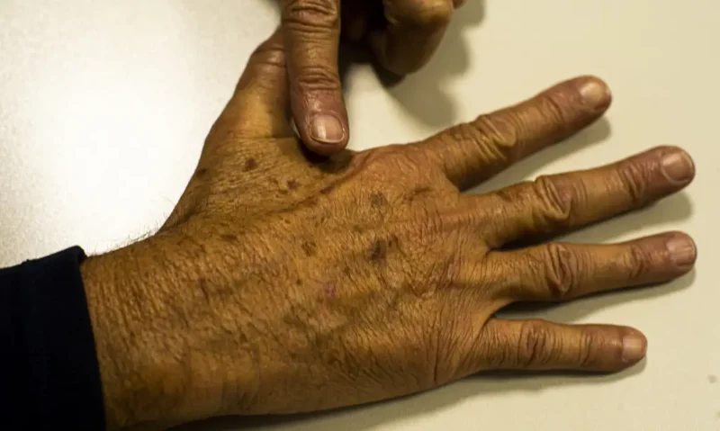 desinformacao-compromete-diagn